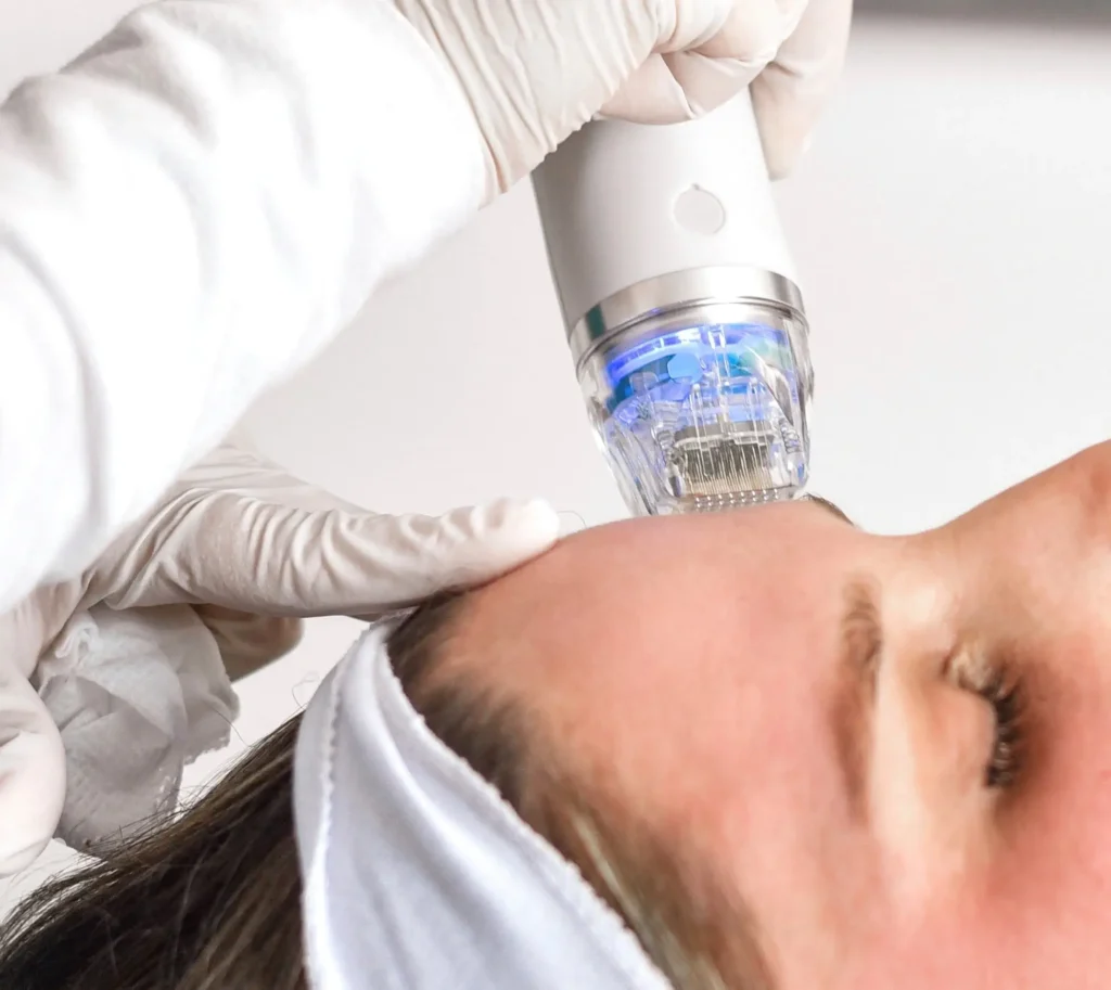 Microneedling in Lehi, UT | Avanti Medical Center
