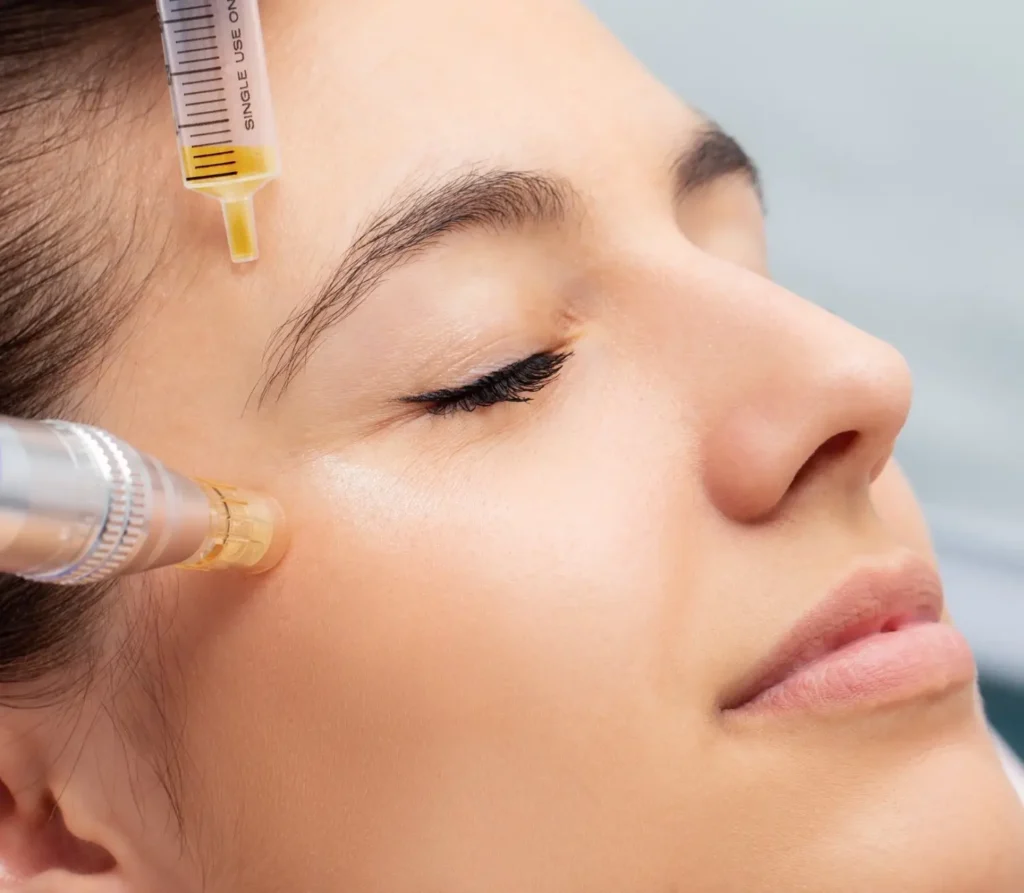 Young Woman Receiving PRP Facial Injections in Lehi, UT | Avanti Medical Center