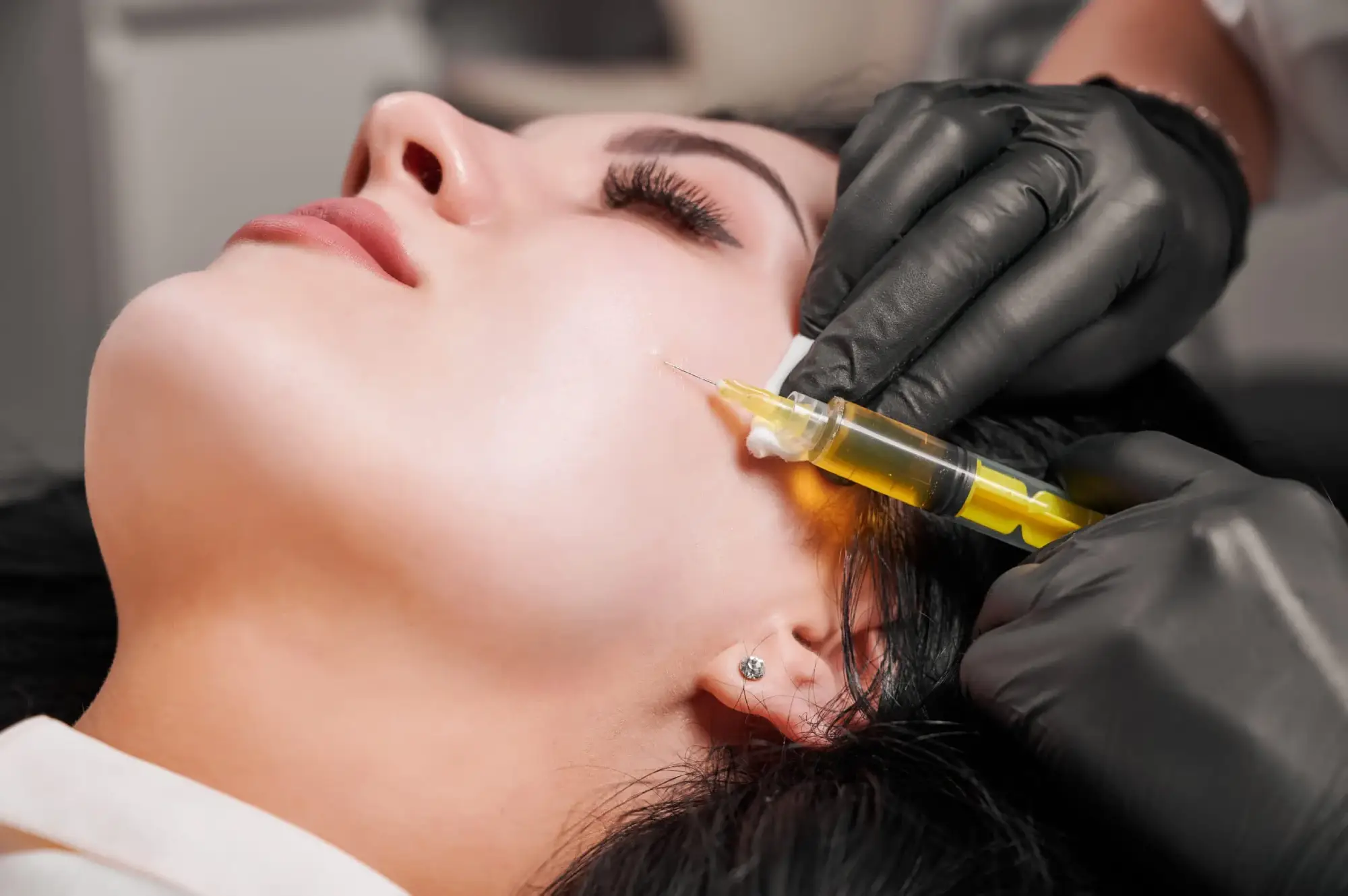 Young Woman Receiving PRP Facial Injections in Lehi, UT | Avanti Medical Center