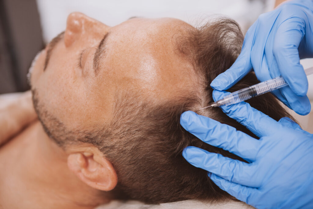 Hair Restoration in Lehi, UT | Avanti Medical Center